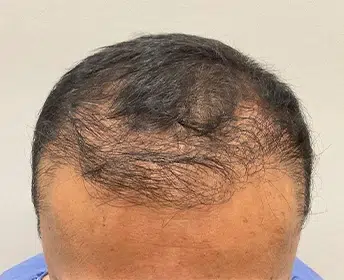 HAIR SPECIALIST